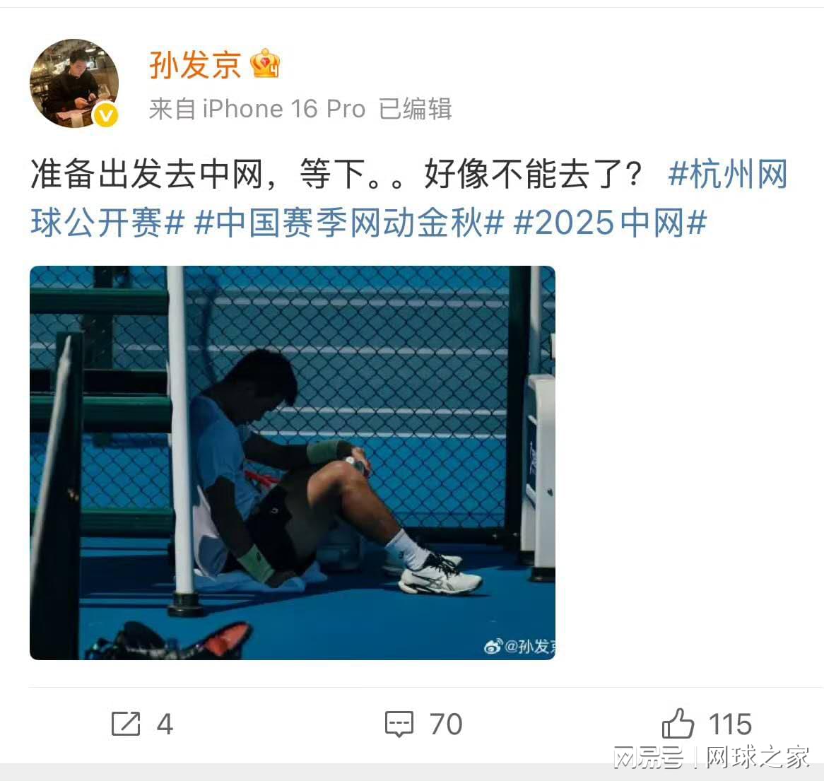 孙发京此次, ue 孙发京此次, ue